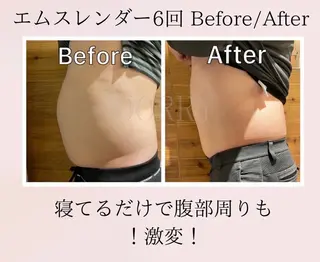 脂肪冷却/美肌改善 COCOKARAのエステ・リラクイメージ