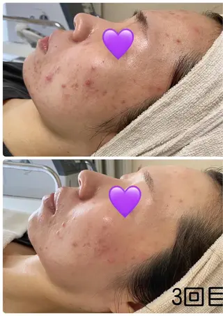 De I'm トータルビューティーサロン所属・COCO beautyサロンのエステ・リラクイメージ