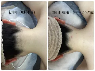 脱毛専門減毛サロン LULU.tokyoのエステ・リラクイメージ