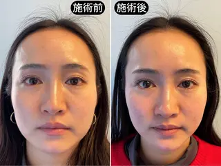 渋谷 小顔美容鍼 専門サロン YZのエステ・リラクイメージ