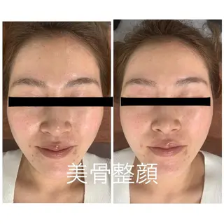 小顔FaceLabo .大府店のエステ・リラクイメージ