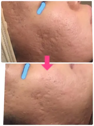 ショート カラー パーマ ヘアアレンジ メンズ キッズ ネイル マツエク・マツパ ‍痩身＆ボディ 結果出し🌟丹野のエステ・リラクイメージ