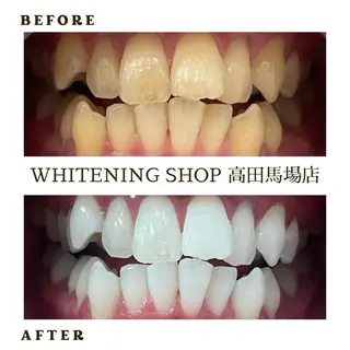 メンズ ホワイトニング ショップ高田馬場店のその他イメージ