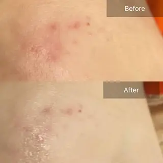 Mandarin Orange所属・毛穴から始める肌メン テマンダリンオレンジのエステ・リラクイメージ