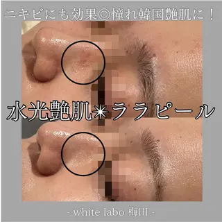韓国肌管理専門店　White labo 梅田店所属・大西 亜季のエステ・リラクイメージ