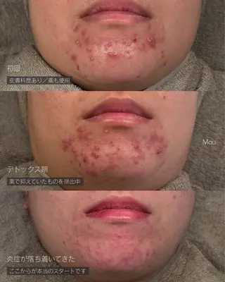 フェイシャルサロン -Mau-のエステ・リラクイメージ