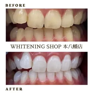 メンズ ホワイトニング ショップ本八幡店のエステ・リラクイメージ