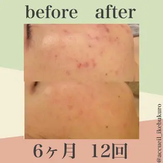 ミディアム カラー パーマ ヘアアレンジ メンズ キッズ ネイル マツエク・マツパ ニキビ・肌質改善専門 ♡人生が変わるサロンのエステ・リラクイメージ