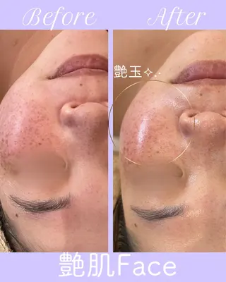 miki 東根の肌質改善サロンのエステ・リラクイメージ