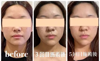 クリーム所属・Nakamura Mikiのエステ・リラクイメージ