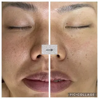 メンズ トータルビューティーサロン LilyRose所属・エステサロン LilyRoseのエステ・リラクイメージ