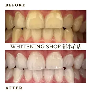 メンズ ホワイトニング ショップ新小岩店のその他イメージ