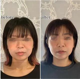 吉田 ひかる (小顔矯正)のエステ・リラクイメージ