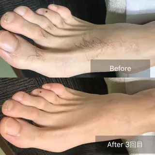 メンズ マンモス脱毛 札幌白石店のその他イメージ