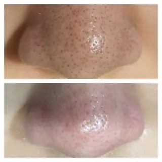 美肌脱毛サロン つるりと御殿場店所属・美肌脱毛サロン つるりとのその他イメージ