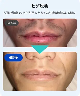 メンズ MEN'S SALON glow所属・メンズ脱毛 glow 中目黒のエステ・リラクイメージ