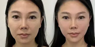 マツエク・マツパ aliaハイフ&水光ジェットサロン所属・aliaハーブ水光店 エステティシャン募集のエステ・リラクイメージ