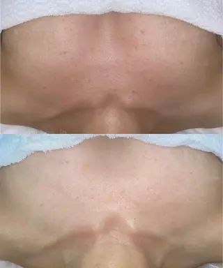 肌質改善 KALANCHOEのエステ・リラクイメージ