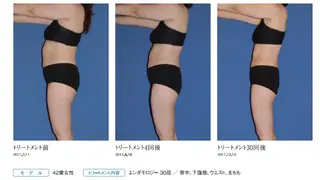 オレンジバナナ 県央店のエステ・リラクイメージ