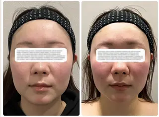 mi yuのエステ・リラクイメージ