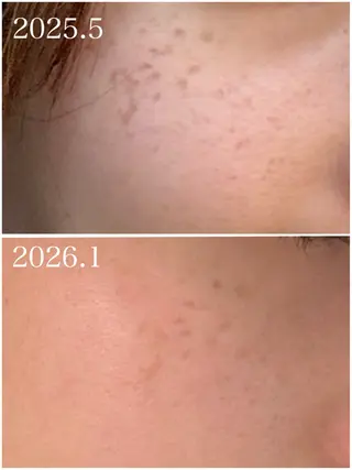 23beauty所属・武藤 那月のエステ・リラクイメージ