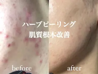 肌管理サロン neoriiのその他イメージ