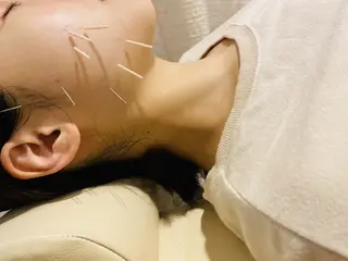 むくみたるみ専門☆ 美容鍼・小顔矯正のエステ・リラクイメージ