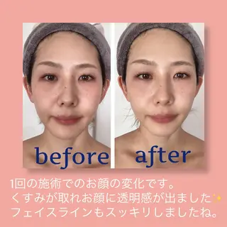 studio acoのエステ・リラクイメージ