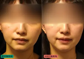 美容とカラダの鍼灸 サロン やなけんのエステ・リラクイメージ