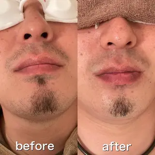 メンズ プライベートサロンLien所属・都度払い脱毛店 Lienリアンのエステ・リラクイメージ