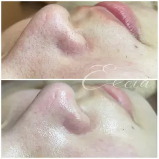 EXCIA所属・EXCIA （エクシア）のエステ・リラクイメージ