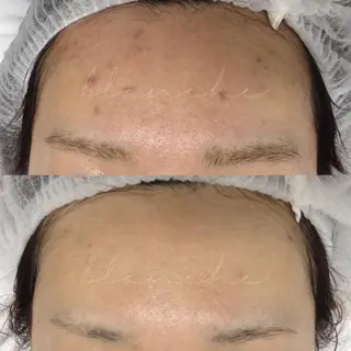 ロング カラー パーマ ヘアアレンジ ネイル マツエク・マツパ アイブロウ 都度払い肌質改善 &脱毛Blancheのエステ・リラクイメージ