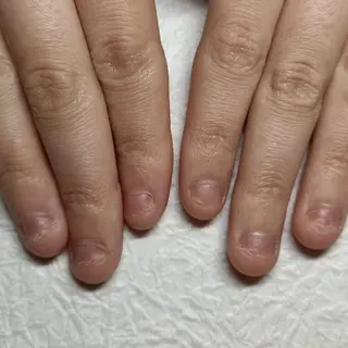 ネイル 深爪矯正/爪育成ケア manie nailのネイルデザイン
