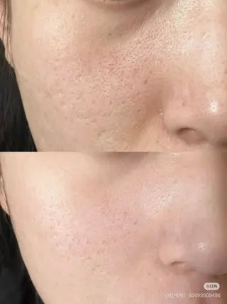 ショート aliaハイフ&水光ジェットサロン所属・aliaハーブ水光店 エステティシャン募集のエステ・リラクイメージ