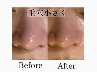 六本木脱毛andS 🍀yuriのエステ・リラクイメージ