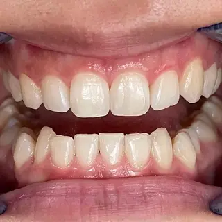 サクッとホワイト所属・セルフホワイトニング サクホワ五反田店のその他イメージ