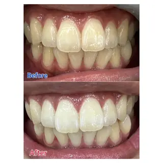 MBEAUTYSALON 千葉店・京成大久保所属・Melty 輝のその他イメージ