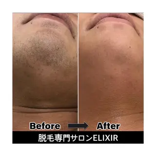 脱毛専門サロンElixir加須店所属・脱毛専門サロン Elixir　加須店のエステ・リラクイメージ