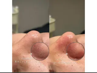 miyu 🩵のエステ・リラクイメージ