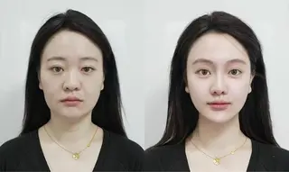 マツエク・マツパ 愛維美水光美肌専門店所属・愛維美水光美肌専門店 メンズレディースokのエステ・リラクイメージ