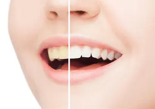 grantier beautyのネイルデザイン