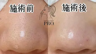 Lipula リプラ所属・毛穴ツヤ肌専門    Lipulaのエステ・リラクイメージ