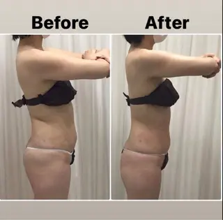 痩身/美肌/脱毛 MAX BEAUTYのエステ・リラクイメージ