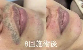大阪脱毛|ちぇるま| 眉毛Wax｜美肌管理のエステ・リラクイメージ