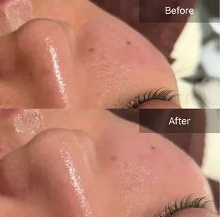 for woman所属・森 美優のエステ・リラクイメージ