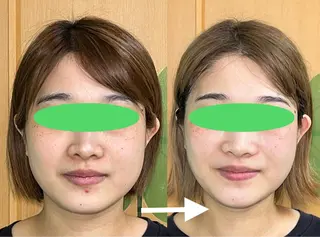 春日井トータルからだ サロンふくふくのエステ・リラクイメージ