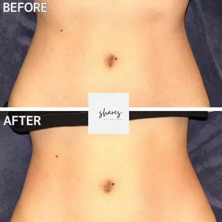 salon shares 辻堂店所属・SHARES AOIのエステ・リラクイメージ