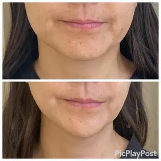 Ailes トータルビューティーのエステ・リラクイメージ