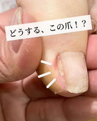 ネイル 深爪・巻き爪 専門サンセリテのネイルデザイン