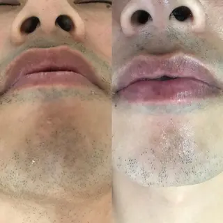 ネイル・脱毛サロンplage所属・脱毛サロン Plageプラージュのエステ・リラクイメージ